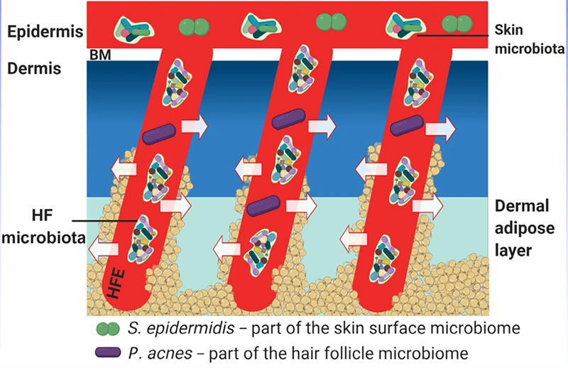 皮肤与头皮微生态紊乱，会带来怎样的皮肤疾病表现？