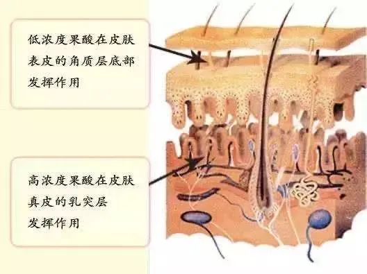 刷酸后皮肤变薄？刷酸后变黑？刷酸后爆痘?你都经历了?