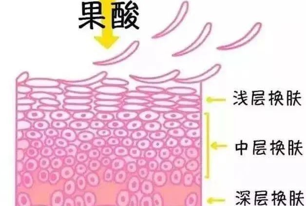 刷酸后皮肤变薄？刷酸后变黑？刷酸后爆痘?你都经历了?