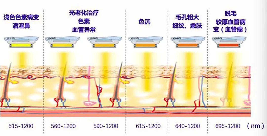 脂溢性皮炎如何治疗？