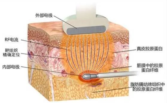 这些医美方法让你比同龄人年轻10岁！