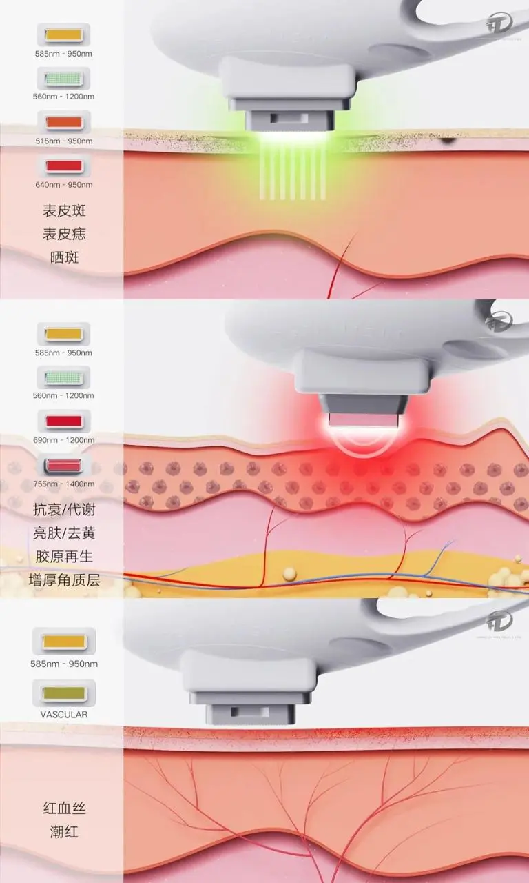 护肤仪器 | 韩国细胞光二代全面升级2.0