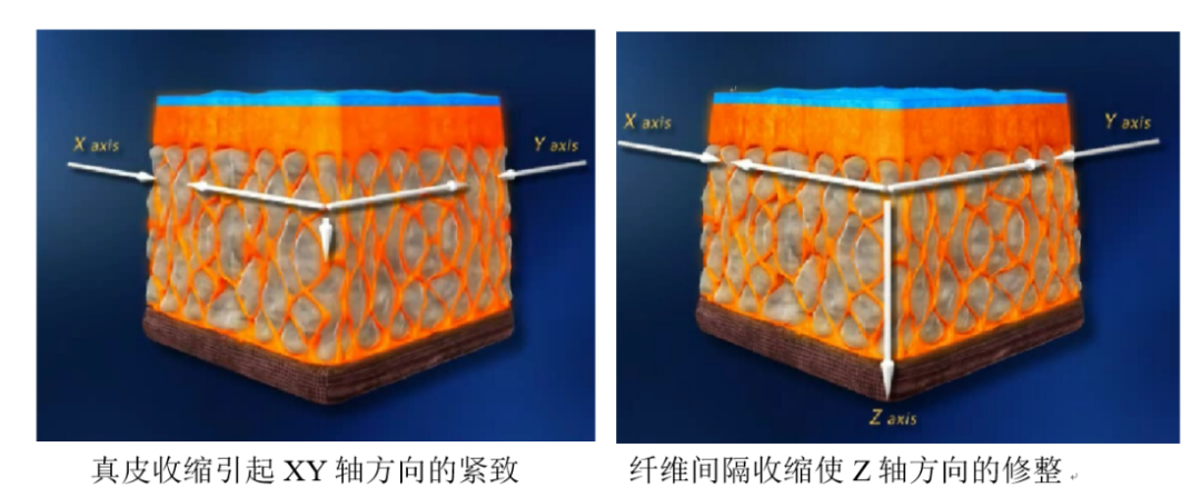 你不会只知道眼周细纹用眼霜吧？！