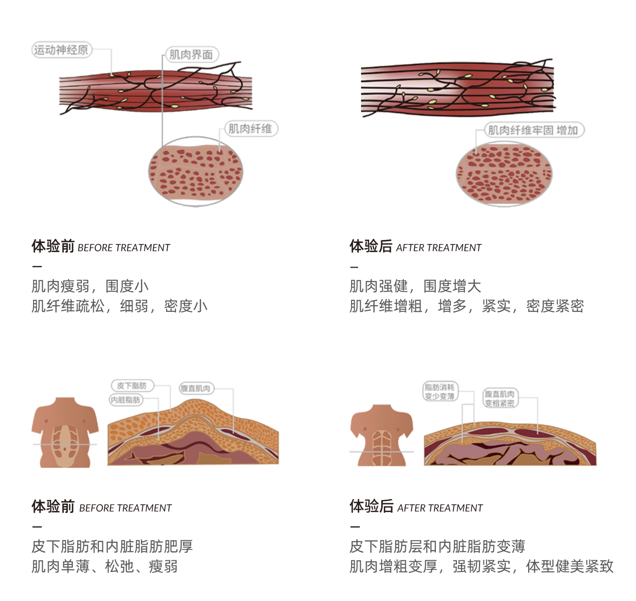 冷冻减脂+电磁增肌，以色列“酷拉美形”发力生美形体市场