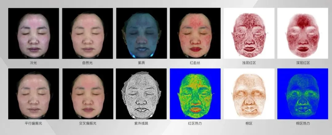 新品上线：美际3D皮肤分析仪——皮肤与形态数字化诊断专家上线采美！医美机构的数字化新基建！