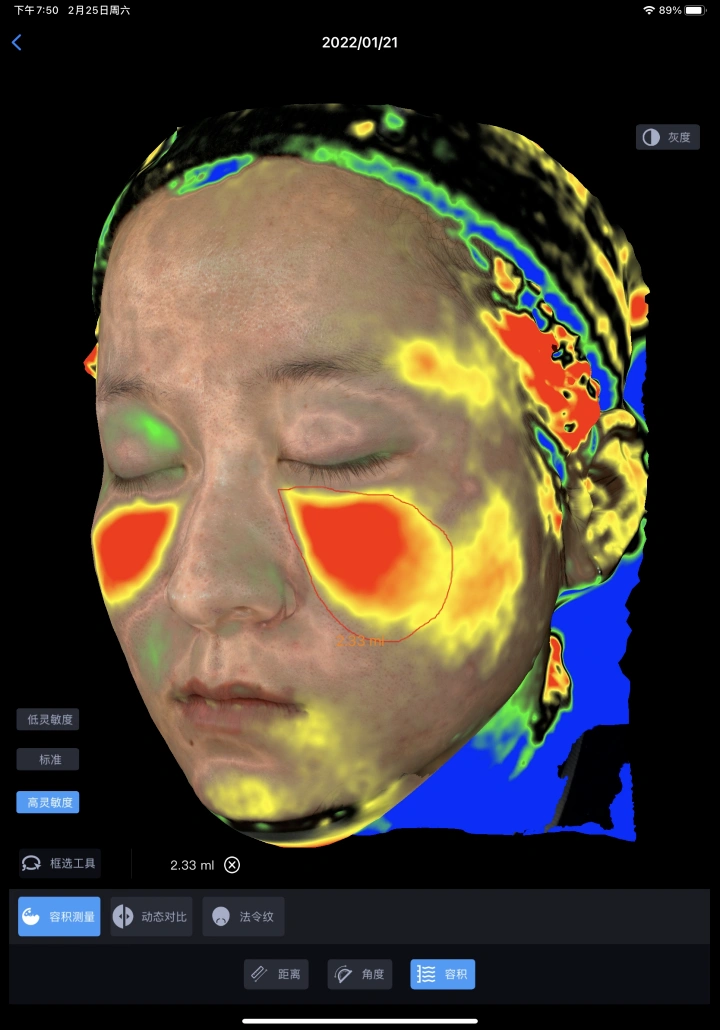 新品上线：美际3D皮肤分析仪——皮肤与形态数字化诊断专家上线采美！医美机构的数字化新基建！