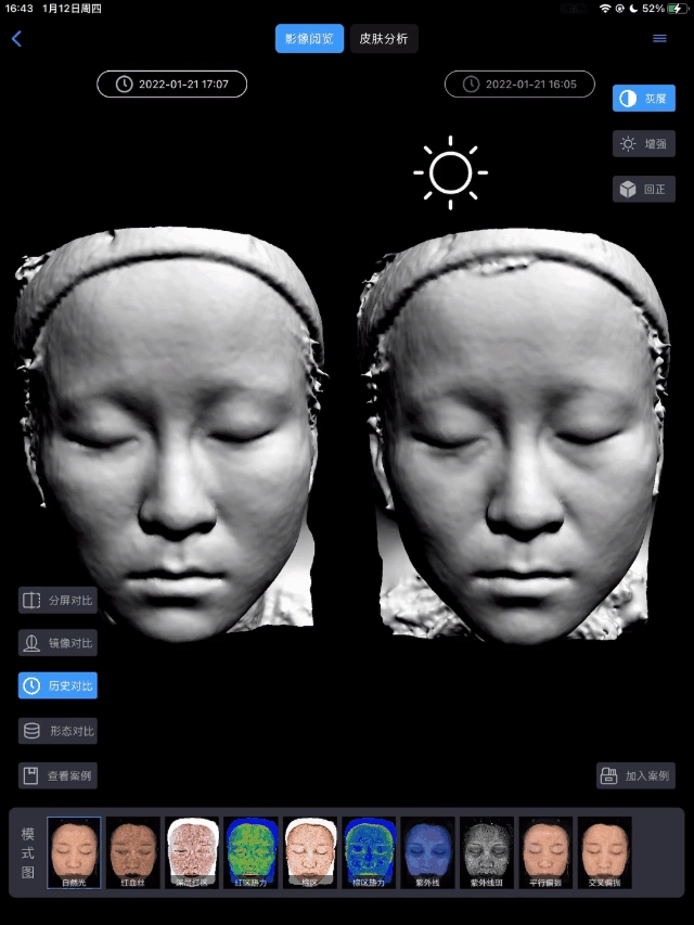 采美科普：美际3D皮肤分析仪如何利用数据构建信任，​打造医美数字化生态体系？