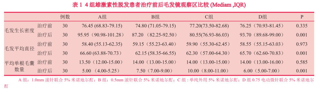 【皮肤美容】微针联合5%米诺地尔酊治疗雄激素性脱发临床疗效分析