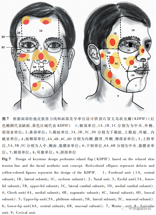 拱顶石穿支岛状皮瓣在面部缺损修复重建中的应用进展