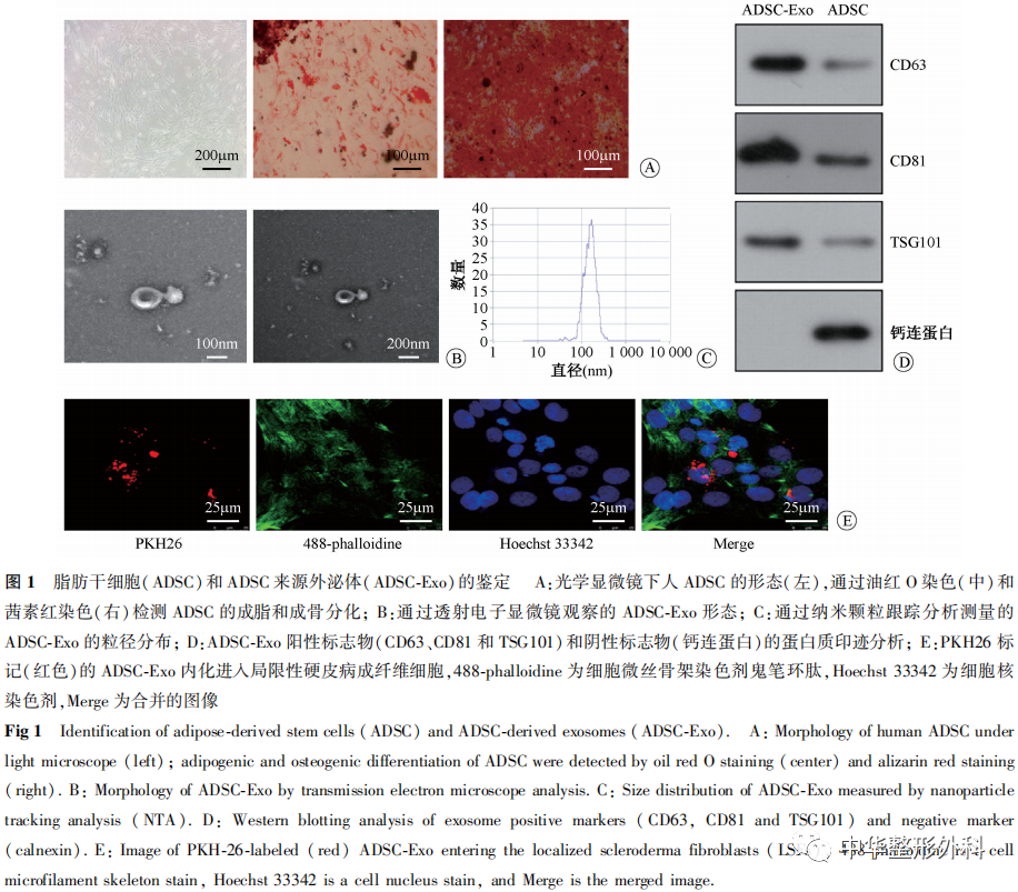 脂肪干细胞来源的外泌体对局限性硬皮病成纤维细胞生物学功能的影响