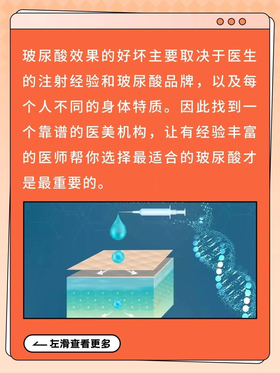 万物皆可玻尿酸？用不对适得其反