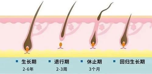 男人脱发必须要满足这两个条件