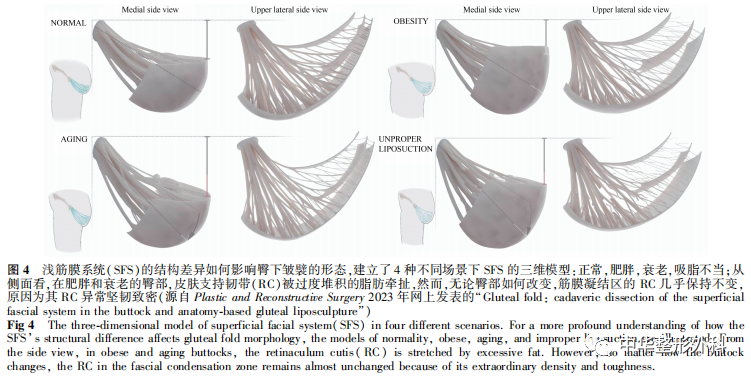 关于皮下脂肪组织浅筋膜系统解剖的系列研究