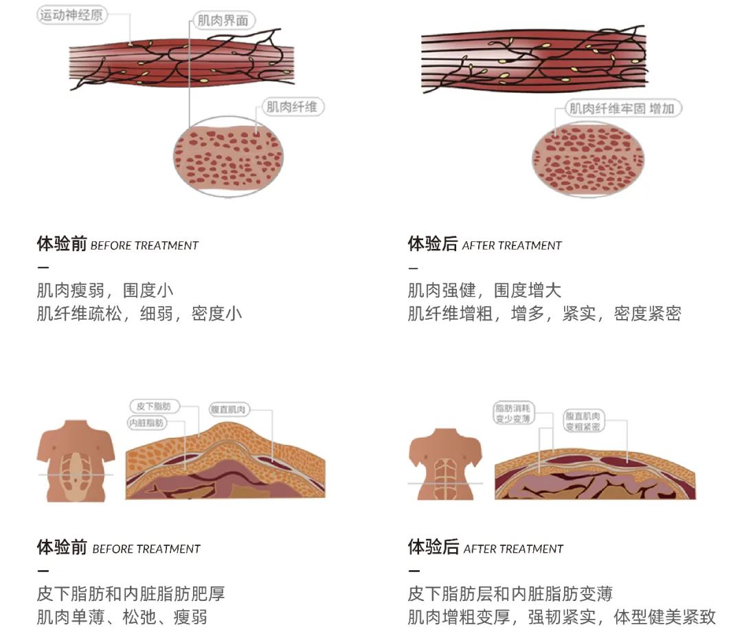 携手《温暖的客栈》，“酷拉美形”如何开拓中国形体美容市场？