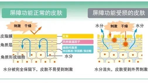 医美科普：什么是皮肤屏障？