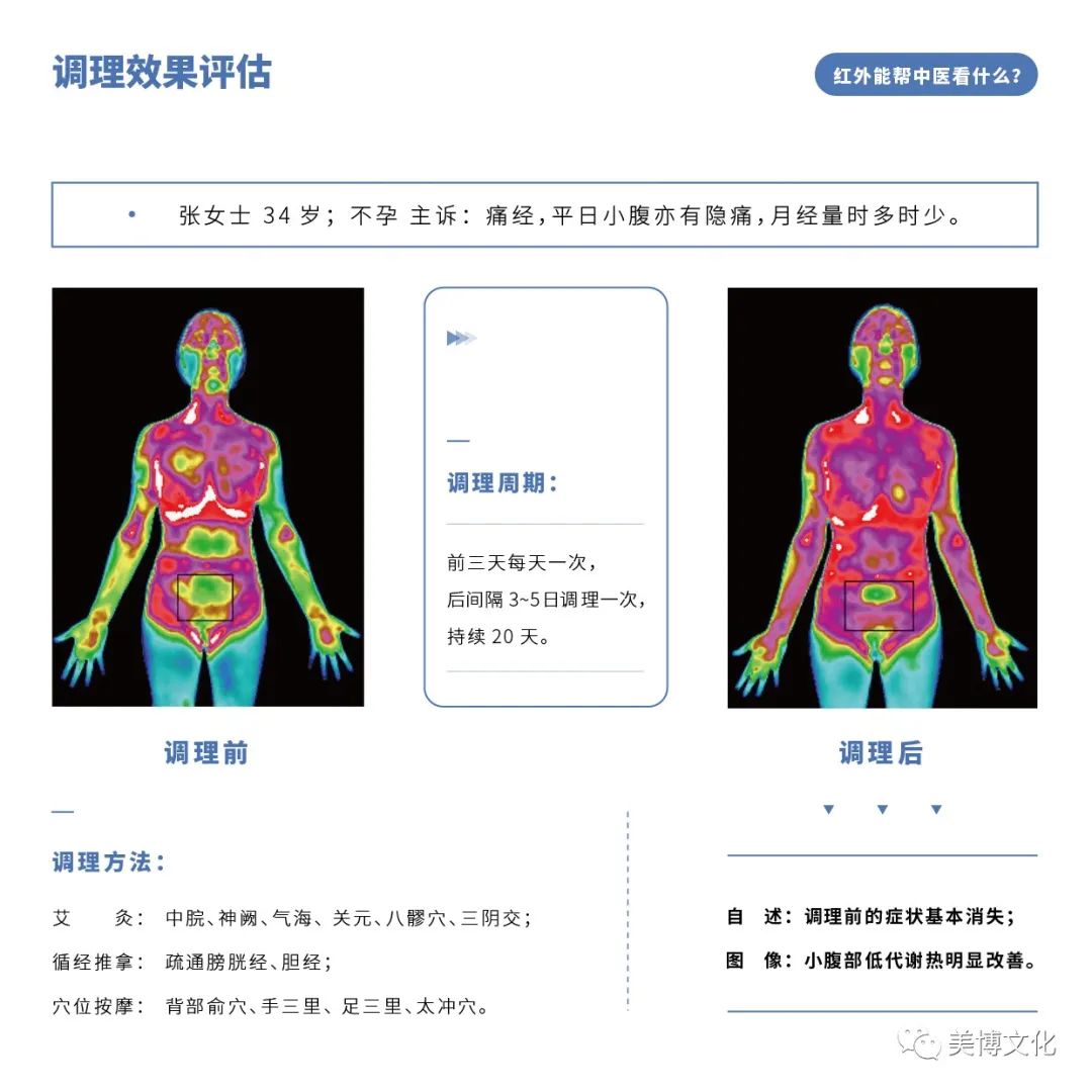 美业先锋杂志推荐 | 【红云科技】红外热成像健康监测专业服务商，诊断全面、早筛查、快速便捷、被动无伤害