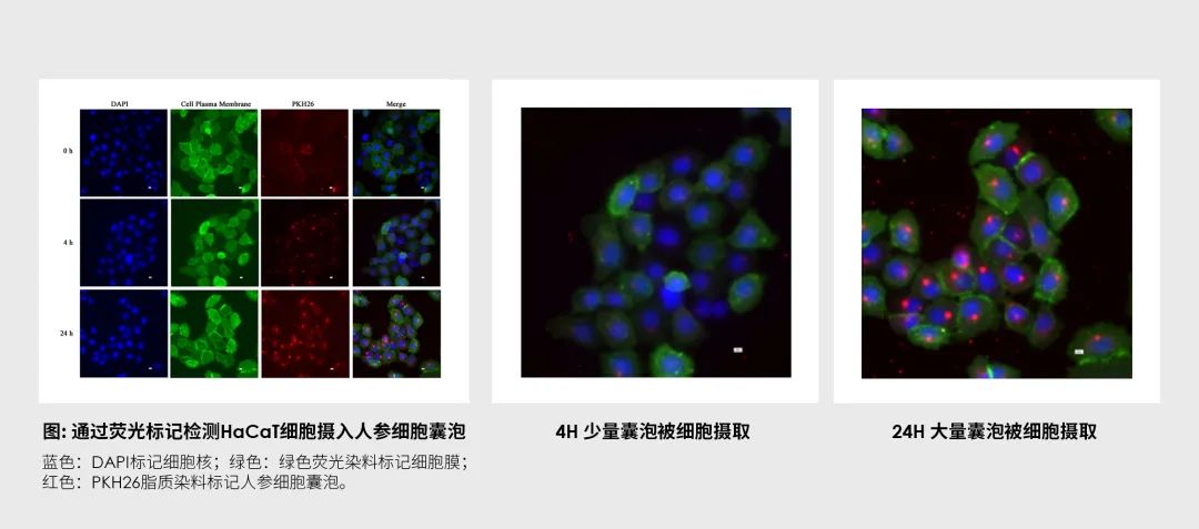 人参细胞囊泡包裹递送技术杀入，美业技术升级大幕即将开启