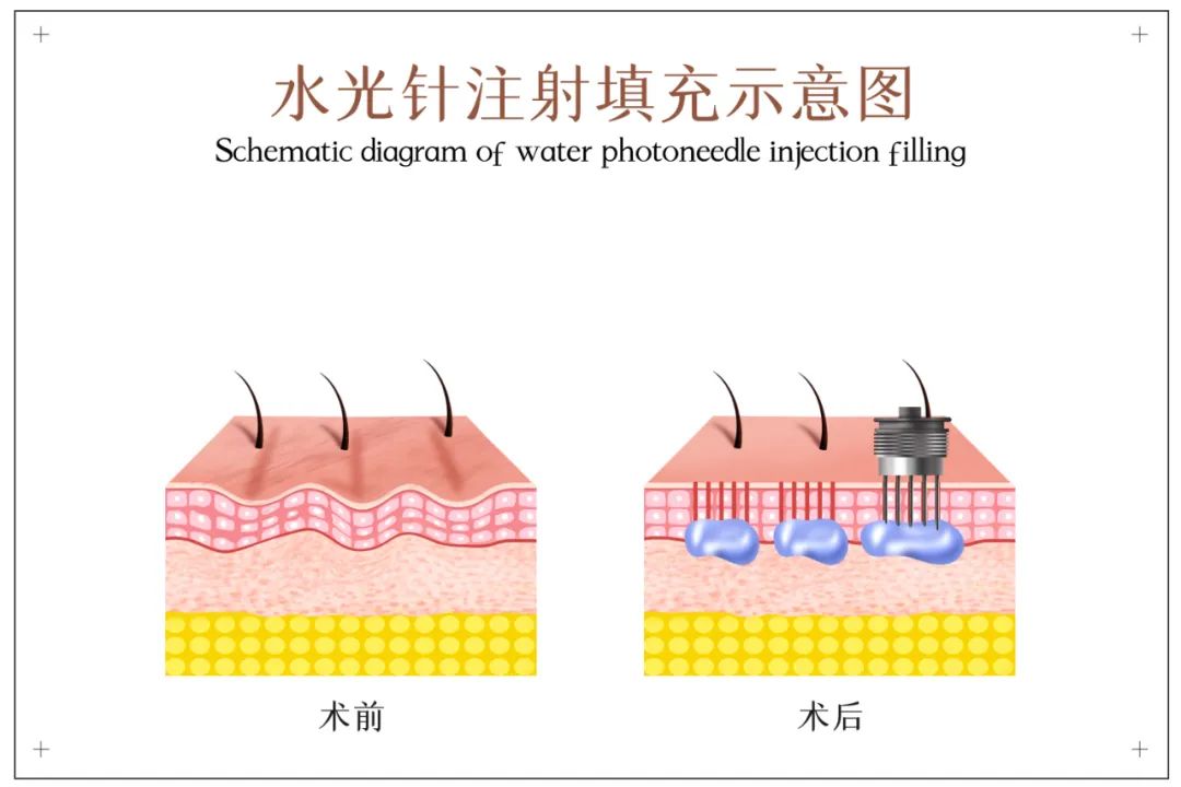 不想贴面膜，怎么补水？