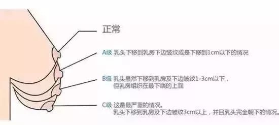 年龄增长后，如何做“坚挺”女人？