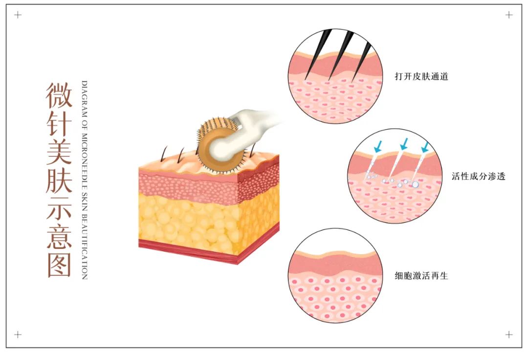 容易被忽视的青春杀手：颈纹