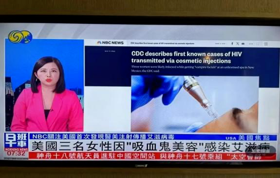 美国多人因使用“吸血鬼面膜”感染艾滋病毒！不正规医美很危险