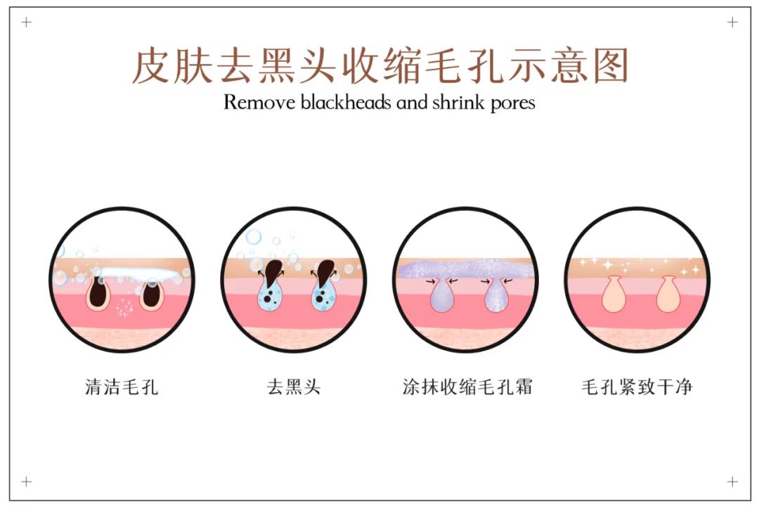 超实用的去黑头攻略来了